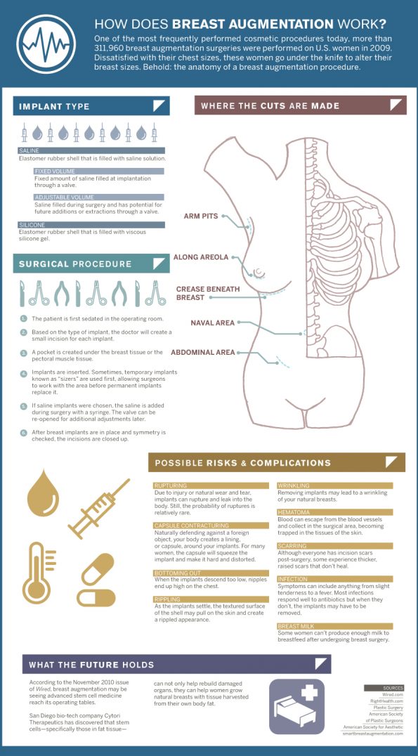 Anatomy-of-Breast-Augmentation-Big